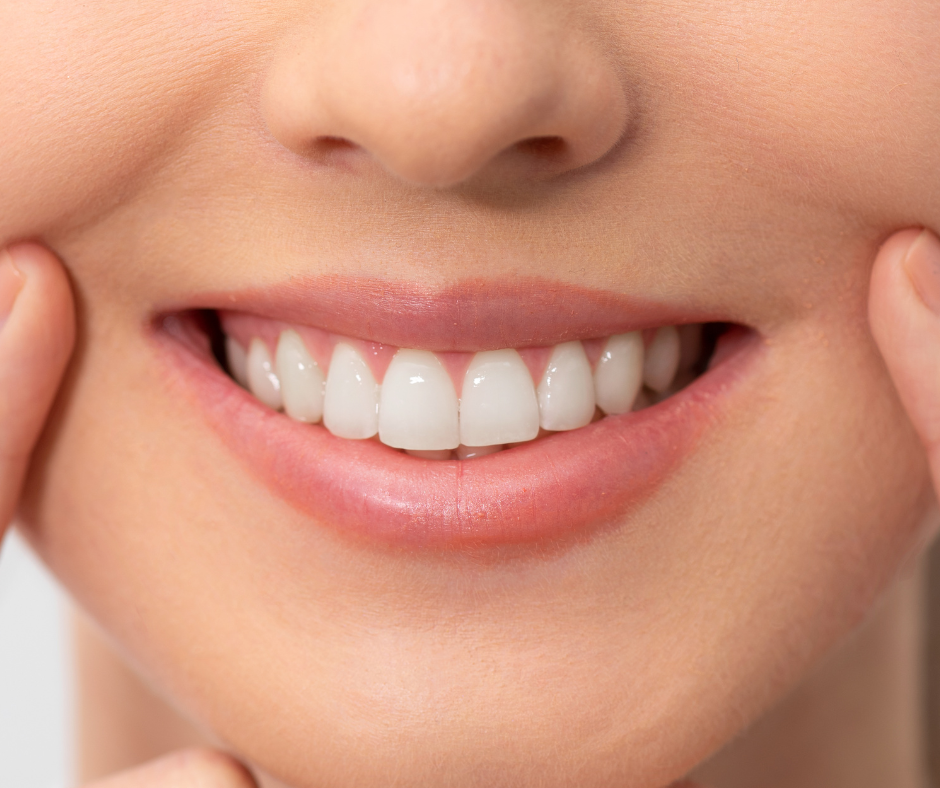 sonrisa sea perfecta